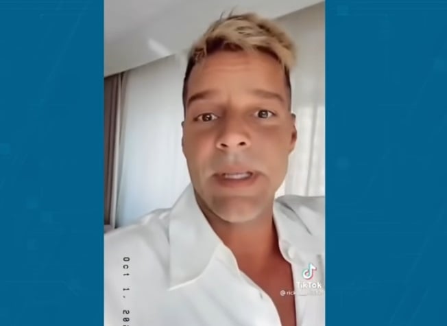 Ricky Martin explica lo que le pasó en su rostro tras polémica