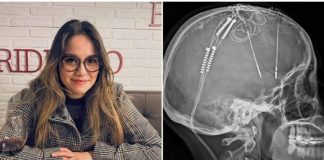 Lorena Rodríguez, la primera mujer que se operó contra la depresión tras luchar 17 años con ella