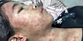 ¿Nueva pandemia? China reporta peligroso brote de virus incapacitante transmitido por mosquitos