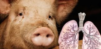 Realizan el primer trasplante de un pulmón de cerdo a un humano