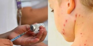 Salud reporta 4 mil 353 casos de sarampión y 17 muertes; 95% están concentrados en Chihuahua