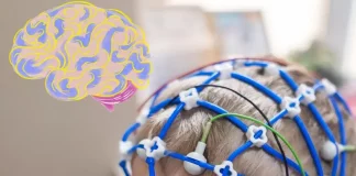 IA ayuda a localizar lesiones cerebrales en niños con epilepsia
