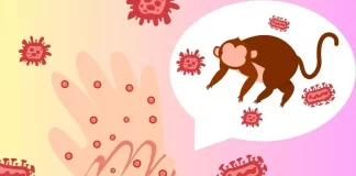 Cepa más grave de mpox detectada por primera vez en Los Ángeles