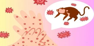 Detectan cepa más grave de mpox en Los Ángeles