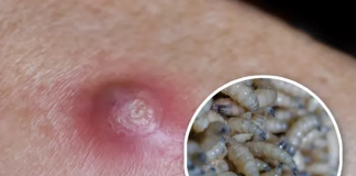 Gusano barrenador en Chiapas: mueren otras 3 personas que fueron portadoras de este mal