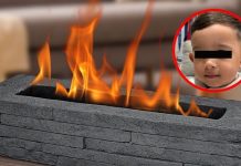 Explota chimenea en la cara de un niño de 3 años, sufre graves quemaduras