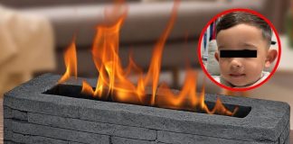 Explota chimenea en la cara de un niño de 3 años, sufre graves quemaduras
