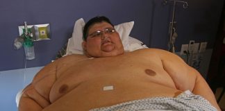 Muere Juan Pedro Franco, mexicano conocido por haber sido el hombre más obeso del mundo
