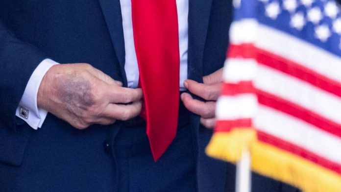 manos-trump-afp-230950