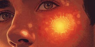 Estudio revela cómo una quemadura solar puede iniciar el cáncer