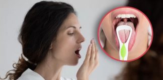 ¿Qué tipo de cáncer causa mal aliento? Esto dicen oncólogos