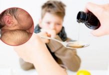 Etiquetan mal medicamento y ahora hay 21 bebés con síndrome del hombre lobo, Fiscalía asegura que no hay ningún delito