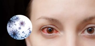 Nodavirus: ¿Cuáles son sus síntomas y por qué preocupa el nuevo virus que causa ceguera?