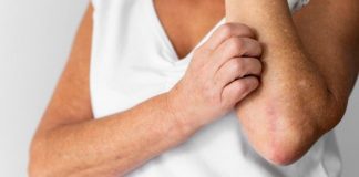 ¿Qué tipo de cáncer provoca picazón en el cuerpo?
