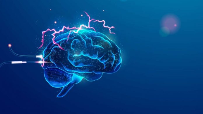 cerebro-105918