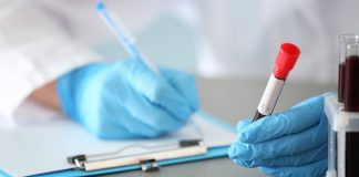 Un análisis de sangre podría detectar y medir el avance del Alzheimer