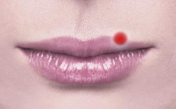 ¿Fuego labial o afta? Descubre su origen y cómo eliminarlos rápido