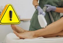 Cofepris alerta por depiladoras de luz falsas; advierte riesgo de lesiones en la piel y los ojos
