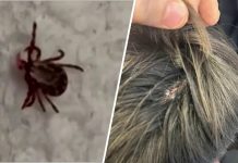 Autoridades reportan casos de tularemia: ¿qué es y cuáles son los síntomas de la extraña “fiebre del conejo”?