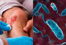 Detectan bacteria carnívora en aguas costeras de EEUU; autoridades de salud lanzan alerta