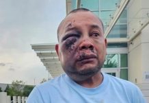 Mexicano termina hospitalizado tras ser golpeado por agentes de ICE durante su detención
