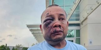 Mexicano termina hospitalizado tras ser golpeado por agentes de ICE durante su detención
