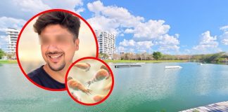 Confirman en Yucatán primera muerte por ameba “comecerebros”; conoce los síntomas del parásito que tiene a México en alerta