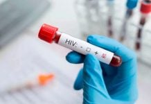 Aumentan casos de VIH en amas de casa: Salud