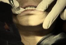 Por una muela picada, un hombre tiene un desenlace fatal al ser inyectado en el dentista